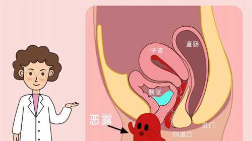 输卵管通水的副作用~助孕服务网址